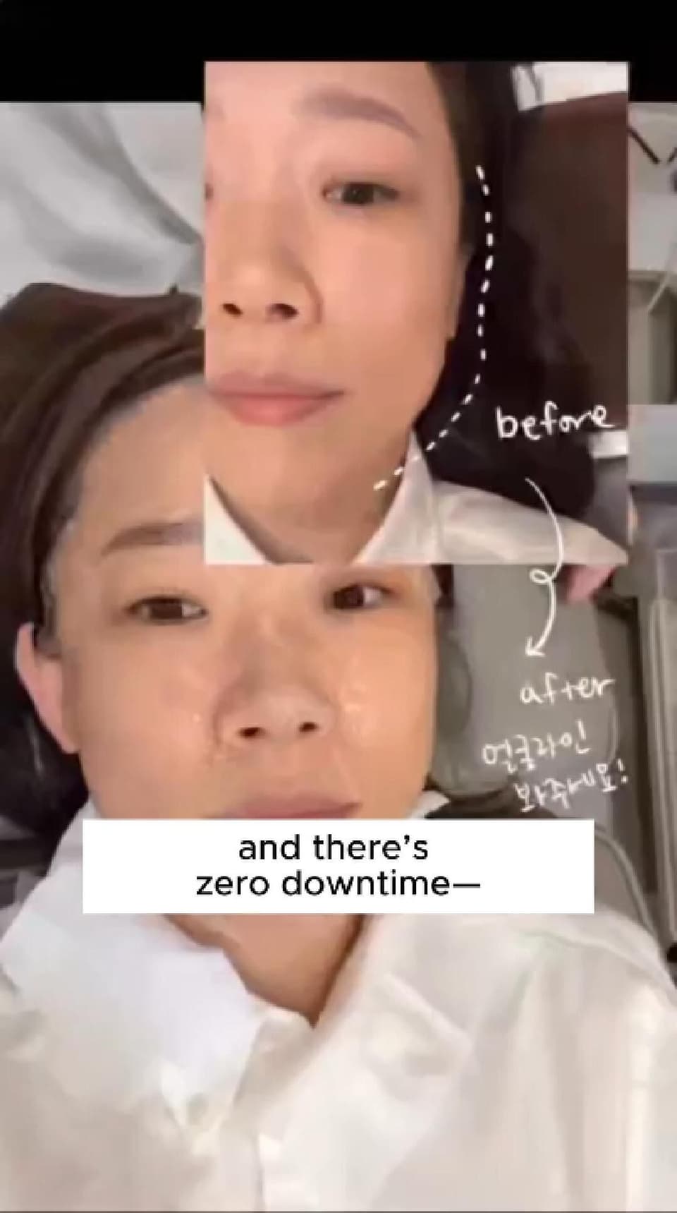 This treatment doesn't hurt at all!