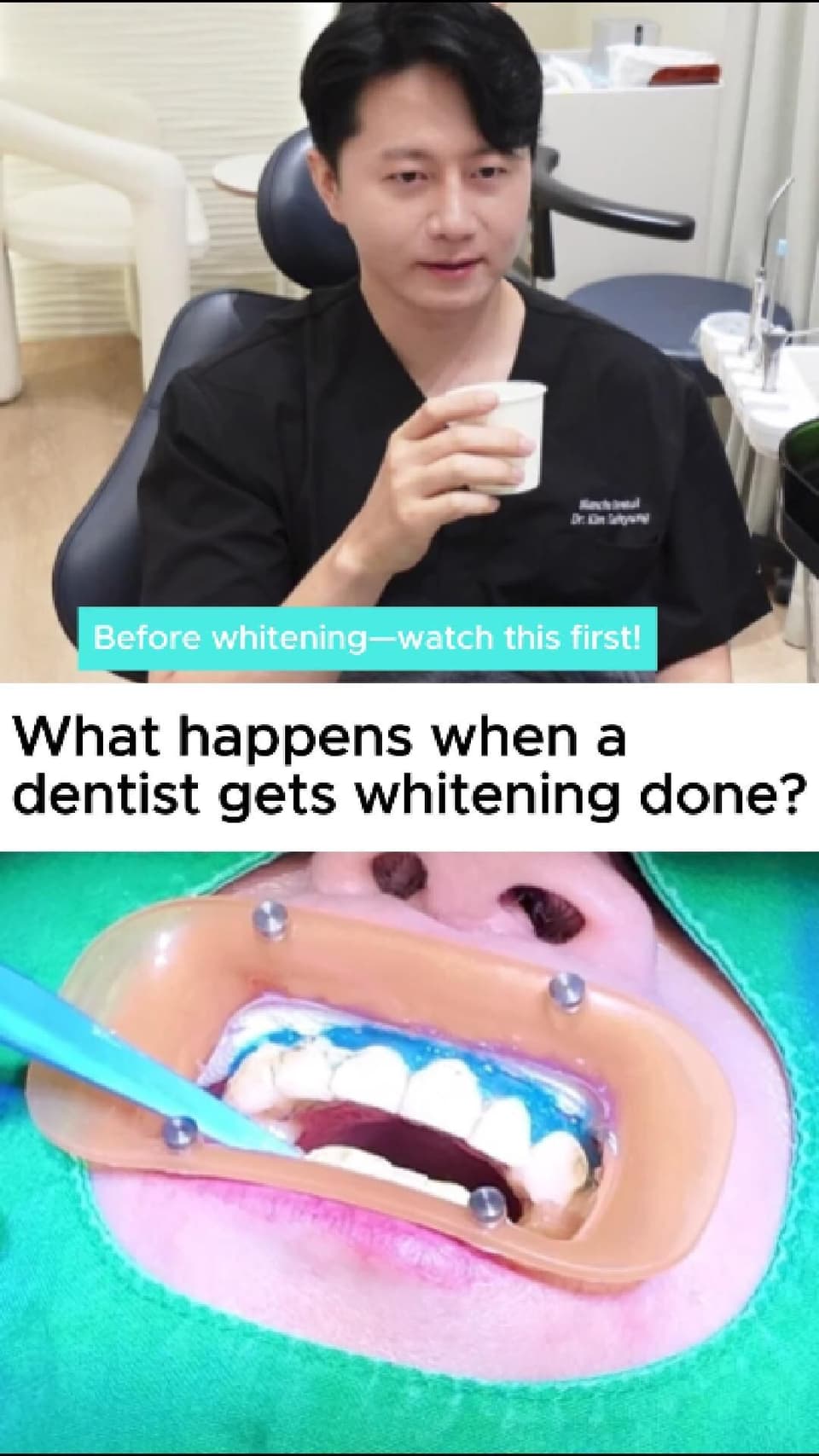 Before whitening — watch this first!