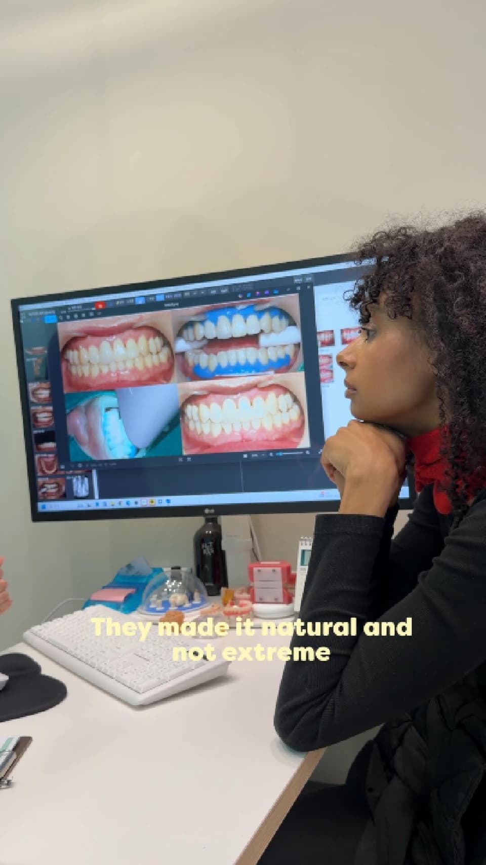 How to get natural white teeth?
