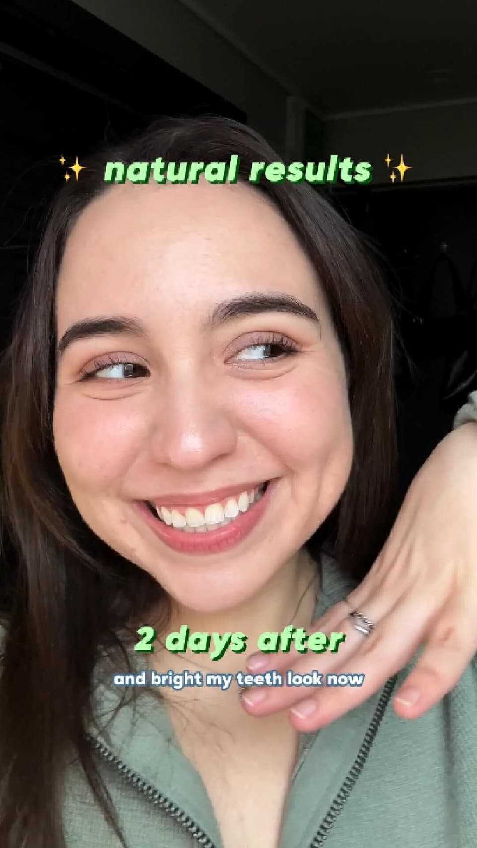 How to make a perfect smile in just one day!