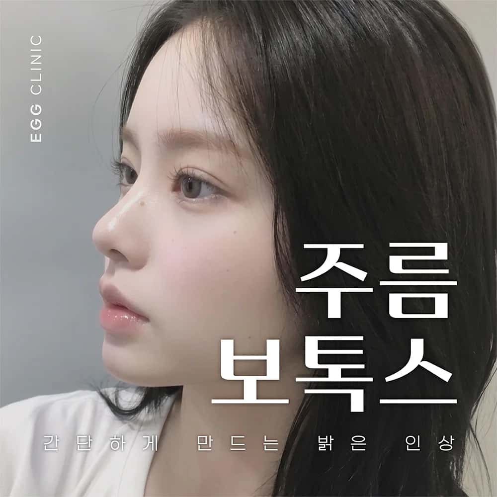 깊어지기 전 자연스럽게, 주름 보톡스